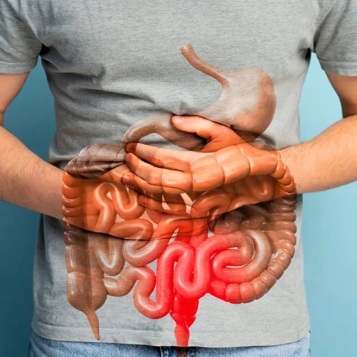 Lucidia™ - GUT SUPPORT CAPSULE